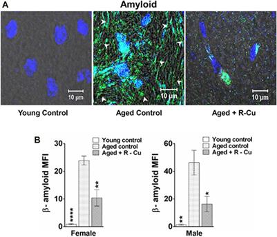 Exploiting the damaging effects of ROS for therapeutic use by deactivating cell-free chromatin: the alchemy of resveratrol and copper